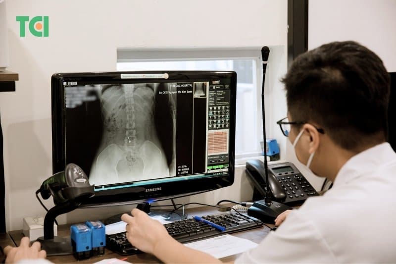 X-quang thường quy phản ánh các giai đoạn tổn thương từ bào mòn đến dính khớp