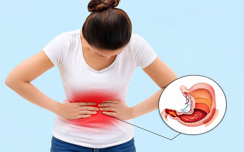 Giãn tĩnh mạch phình vị do áp lực tĩnh mạch cửa tăng cao