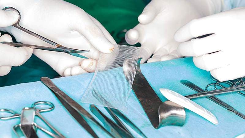 Phẫu thuật là phương pháp điều trị thoát vị đùi chủ yếu, giúp đưa mô hoặc tạng thoát vị về vị trí ban đầu và gia cố vùng thành bụng bị yếu