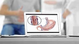 Giãn tĩnh mạch thực quản: Vì sao xảy ra và phòng ngừa thế nào?