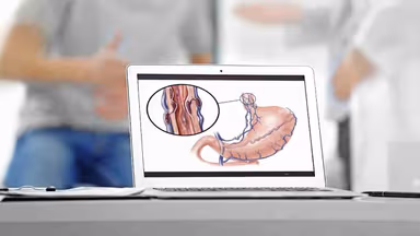 Giãn tĩnh mạch thực quản: Vì sao xảy ra và phòng ngừa thế nào?