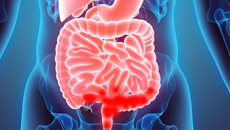 Xuất huyết tiêu hóa dưới là tình trạng chảy máu xảy ra ở phần dưới của đường tiêu hóa, chủ yếu từ đại tràng, trực tràng hoặc hậu môn