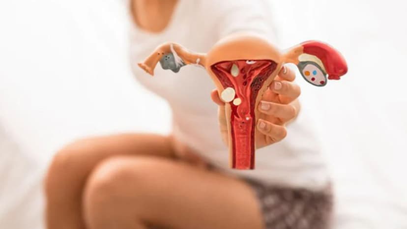 Lạc nội mạc tử cung là gì? Triệu chứng, nguyên nhân và hướng điều trị