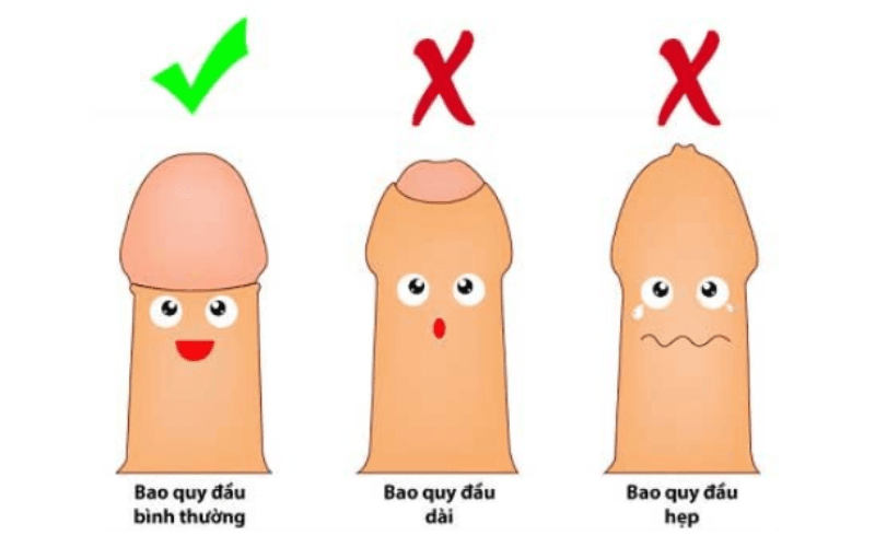 Nguyên nhân hẹp bao quy đầu