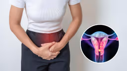 Ung thư cổ tử cung: Nhận biết dấu hiệu di căn như thế nào?