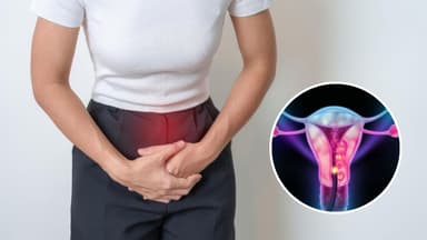 Ung thư cổ tử cung: Nhận biết dấu hiệu di căn như thế nào?