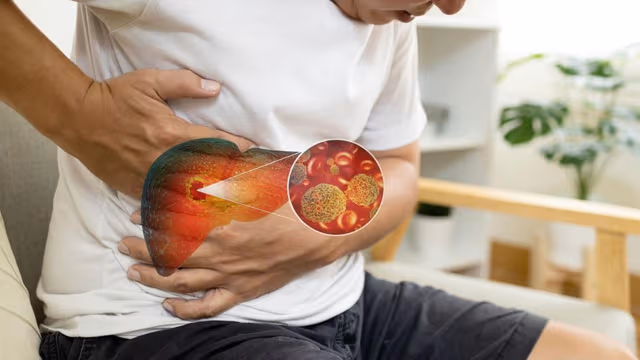Nhận biết dấu hiệu ung thư gan giai đoạn đầu