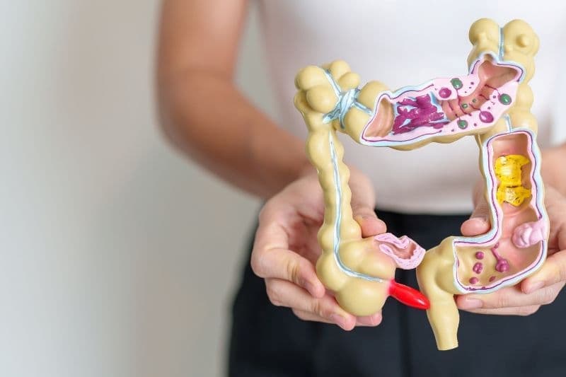 Phần lớn polyp đại tràng sigma, đặc biệt là polyp nhỏ, không gây triệu chứng rõ ràng