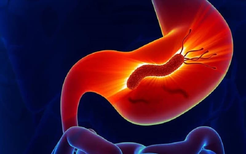 Thực hiện lối sống vệ sinh là giải pháp then chốt trong việc phòng ngừa nhiễm Helicobacter pylori