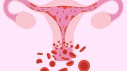 Polyp nội mạc tử cung có nguy hiểm không và cách điều trị