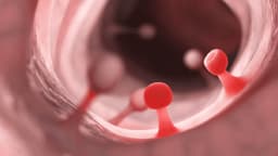 Polyp thực quản là gì và tình trạng này có nguy hiểm không?