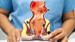 Trĩ sau sinh: Nguyên nhân, dấu hiệu nhận biết và cách điều trị hiệu quả