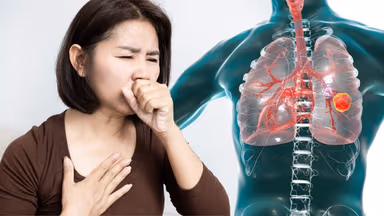 Ung thư phổi không tế bào nhỏ là gì? Nguyên nhân và điều trị