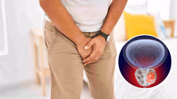 Ung thư tuyến tiền liệt: Dấu hiệu và tầm soát phát hiện sớm