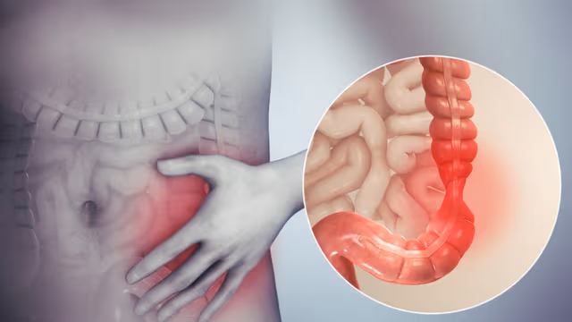Viêm trực tràng: Nguyên nhân, triệu chứng, chẩn đoán và cách điều trị