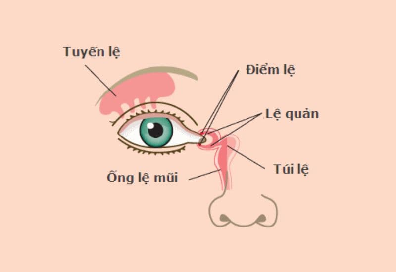 viêm tuyến lệ