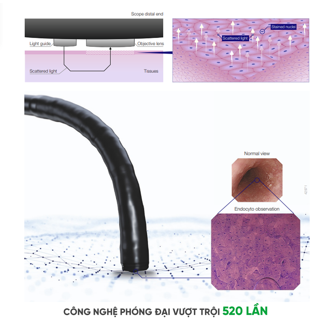 Độ phóng đại vượt trội 520 lần