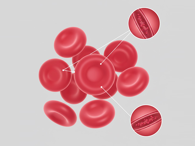 Hình minh họa chuẩn đoán