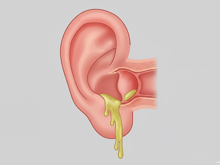 Hình minh họa chuẩn đoán