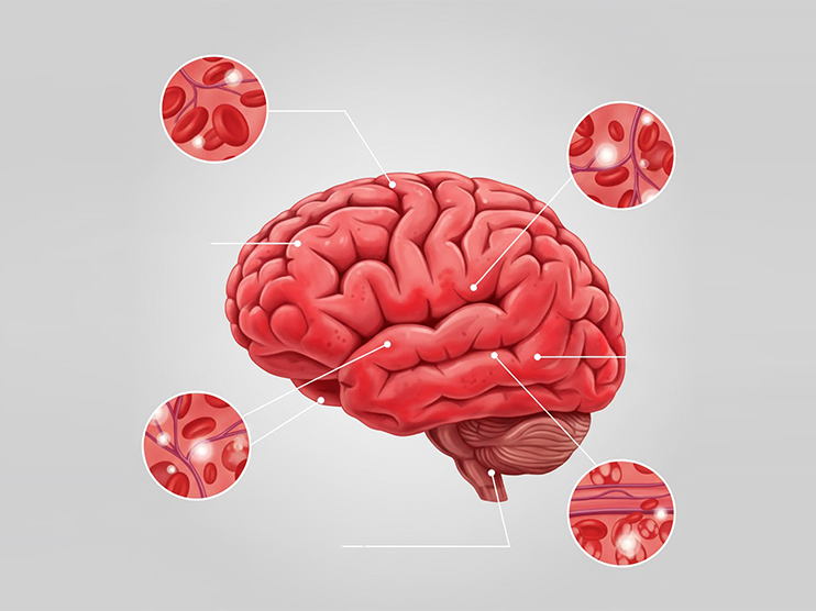 Hình minh họa chuẩn đoán