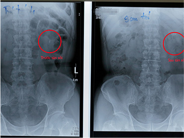 Phim chụp Chú Bùi Công Chính