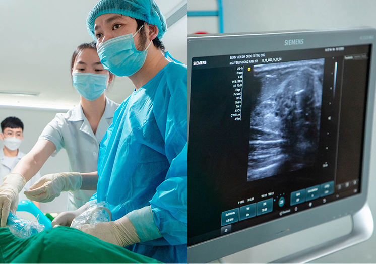 Cơ chế thực hiện