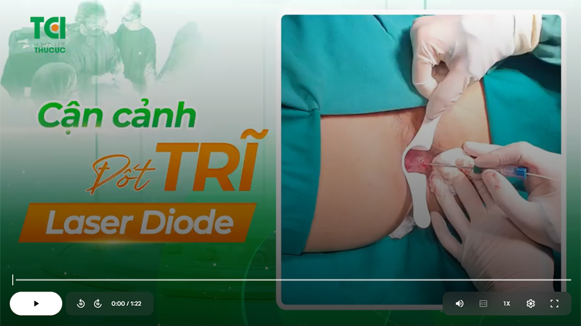 CẬN CẢNH ĐỐT TRĨ LASER DIODE TẠI THU CÚC TCI