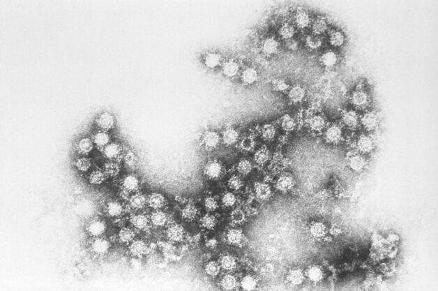Coxakievirus gây đau mắt đỏ