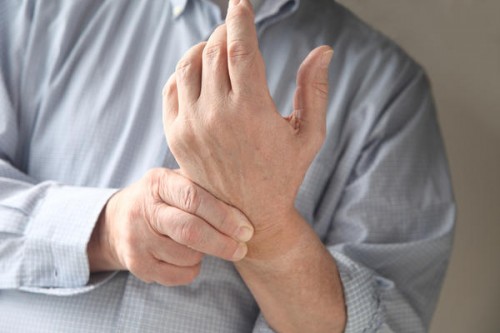 Đau mỏi khớp cổ tay là bệnh gì? Cách điều trị hiệu quả TRIỆT ĐỂ nhất 1