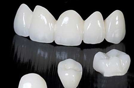Để vừa đảm bảo chức năng nhai, vừa đảm bảo sức khỏe chung cho cả hàm răng và đảm bảo tính thẩm mỹ, làm răng giả nhựa là biện pháp giúp bù đắp khi bị mất răng.