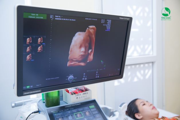 Thai 30 tuần là mấy tháng là băn khoăn của nhiều mẹ bầu.