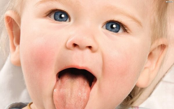 các bệnh về lưỡi ở trẻ em