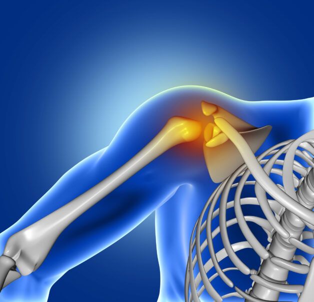Viêm khớp là bệnh có triệu chứng thế nào