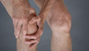 Điều trị viêm khớp phản ứng phải được tiến hành sớm tại các chuyên khoa Cơ xương khớp uy tín