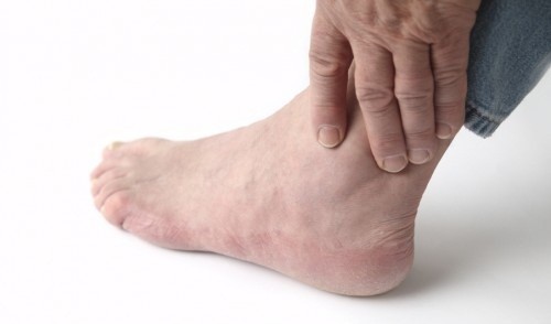 Bệnh viêm khớp cổ chân cũng như các dạng viêm khớp khác là sự suy thoái và bào mòn của lớp sụn và phần xương dưới sụn ở cổ chân.