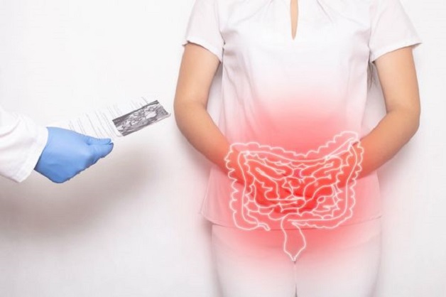 Bệnh viêm đại tràng xuất huyết nguyên nhân