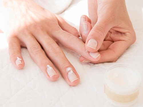Bệnh nấm móng tay không nguy hiểm nhưng làm ảnh hưởng đến sinh hoạt và thẩm mỹ