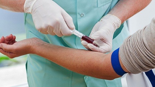 Người bệnh có thể được yêu cầu xét nghiệm máu để chẩn đoán bệnh lupus ban đỏ hệ thống.