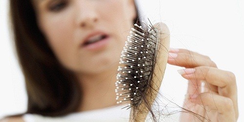Những người bị lupus có thể trải qua thời kỳ rụng tóc.