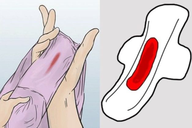 Dấu hiệu của ung thư cổ tử cung
