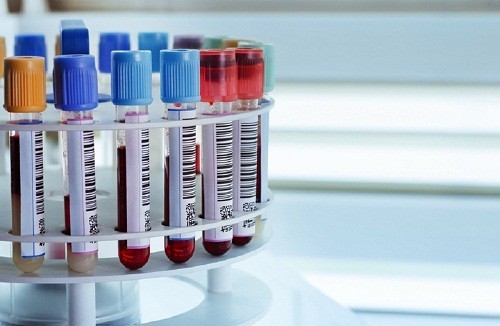 Xét nghiệm chức năng gan kiểm tra nồng độ của một số enzyme và protein trong máu. 