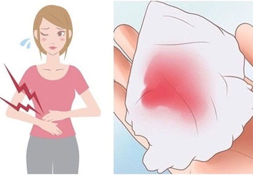 dấu hiệu ung thư cổ tử cung giai đoạn đầu