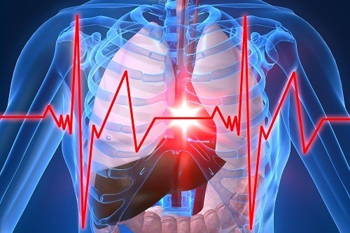 Chóng mặt, buồn nôn và ói mửa là triệu chứng phổ biến của một cơn nhồi máu cơ tim. 
