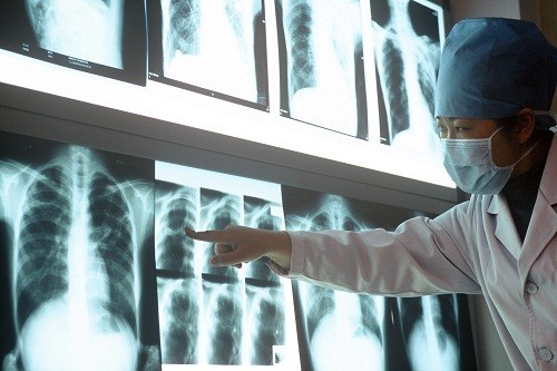 Các xét nghiệm khác như chụp X quang, xét nghiệm đờm, có thể được thực hiện thêm để khẳng định một người có mắc bệnh lao hay không nếu kết quả xét nghiệm lao qua da là dương tính.
