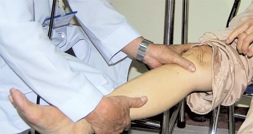 Cách điều trị bệnh đau khớp gối khi lên xuống cầu thang