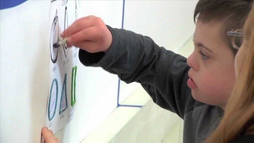 Hội chứng Down kéo dài suốt đời và không thể chữa khỏi.