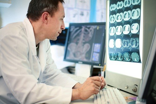 Hiện nay, xét nghiệm hiệu quả nhất trong chẩn đoán giãn phế quản chụp CT phổi độ phân giải cao (HRCT). 