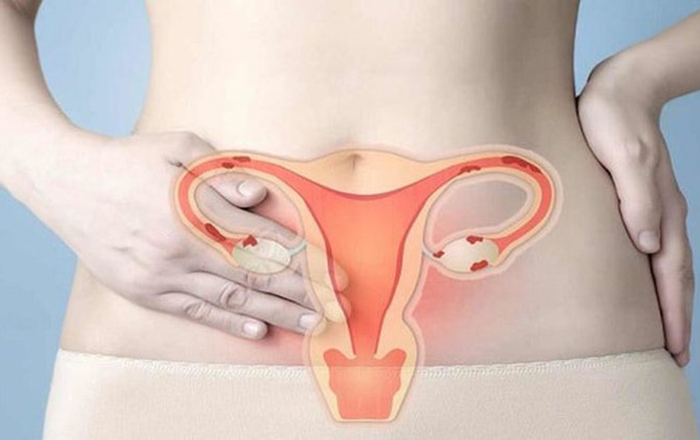 Cổ tử cung cao có thể khiến cho tinh trùng và trứng khó gặp nhau để thụ thai