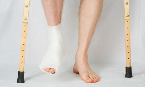 Khi bó bột, bệnh nhân tránh di chuyển nhiều để xương được cố định