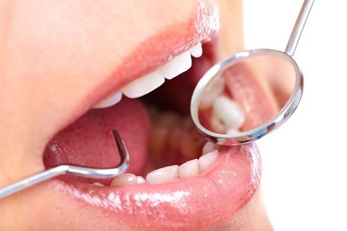 Vì có nguy cơ cao mắc các bệnh về răng miệng nên bệnh nhân tiểu đường nên đi khám răng định kỳ, ít nhất là 2 lần/năm theo hướng dẫn của bác sĩ.